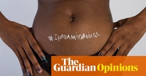 Miscarriages change our bodies as much as childbirth. Can we talk about that? | Jessica Zucker and Sara Gaynes Levy