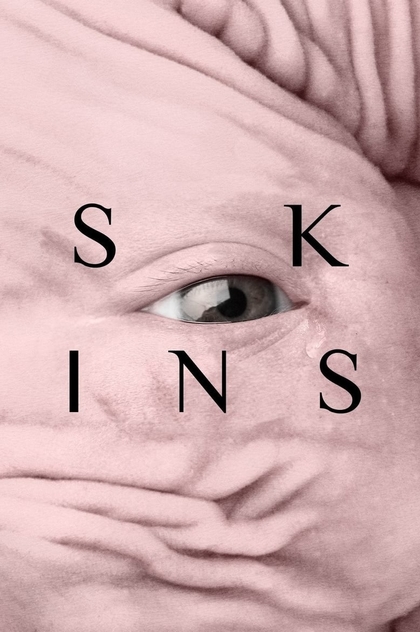 Skins - 2017